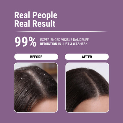 ANTI-DANDRUFF SHAMPOO
