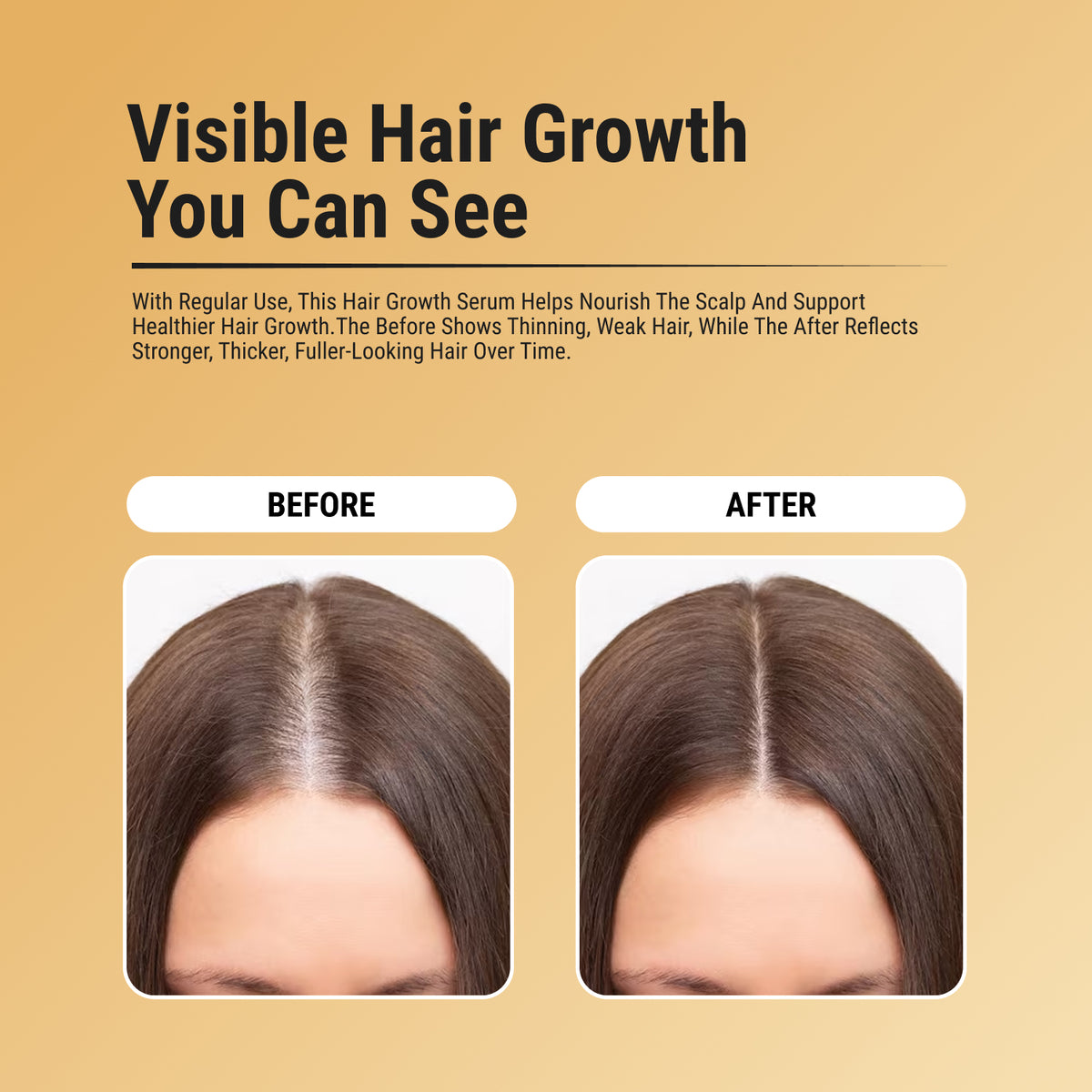 HAIR GROWTH SERUM
