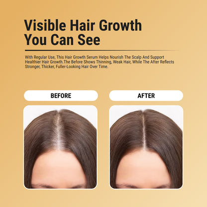 HAIR GROWTH SERUM